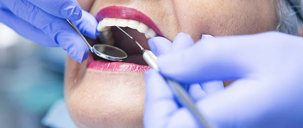 Best Emergency Tooth Extraction in The Hills, TX